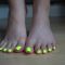 feet 3661 24-07-2021 Neon yellow nail…