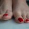 feet 3727 26-07-2021 Red spitty toes …